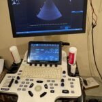 2D Echocardiography (2D Echo)